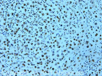 Immunohistochemistry (Formalin/PFA-fixed paraffin-embedded sections) - Anti-SNF2H antibody (AB72499)