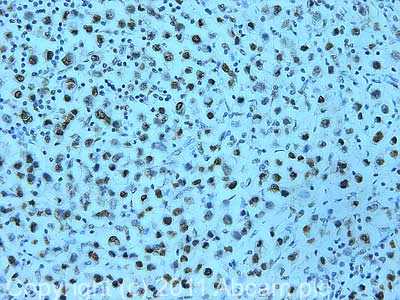 Immunohistochemistry (Formalin/PFA-fixed paraffin-embedded sections) - Anti-SNF2H antibody (AB72499)