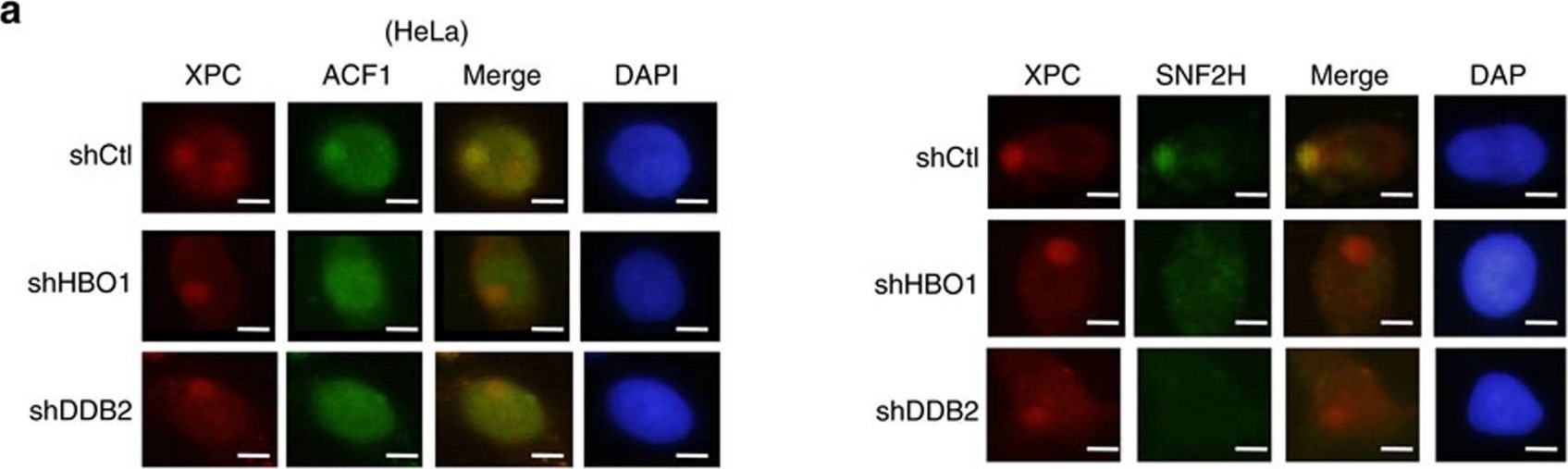 Immunocytochemistry/ Immunofluorescence - Anti-SNF2H antibody - ChIP Grade (AB3749)