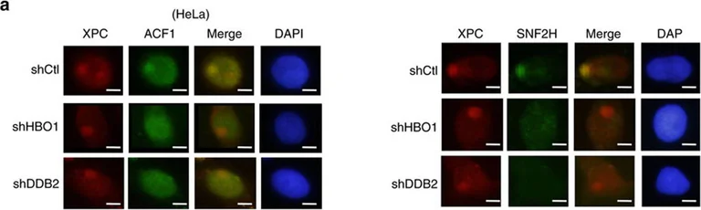 Immunocytochemistry/ Immunofluorescence - Anti-SNF2H antibody - ChIP Grade (AB3749)