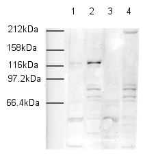 Western blot - Anti-SNF2H antibody - ChIP Grade (AB3749)