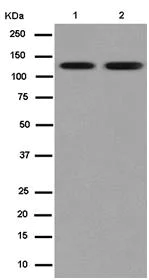 Western blot - Anti-SNF2H antibody [EPR7673(2)] (AB183730)