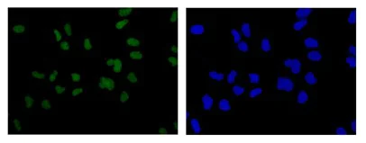 Immunocytochemistry/ Immunofluorescence - Anti-SNF2H antibody [EPR7673(2)] - BSA and Azide free (AB250702)
