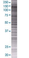 SNF2H overexpression 293T lysate (whole cell)
