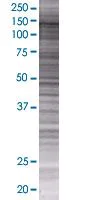 SDS-PAGE - SNF2H overexpression 293T lysate (whole cell) (AB94304)