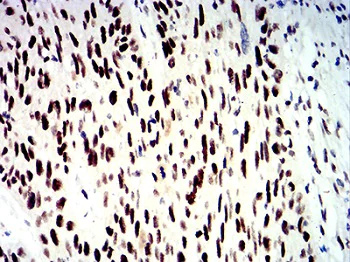 Immunohistochemistry (Formalin/PFA-fixed paraffin-embedded sections) - Anti-SNF2L antibody [2H7B9] (AB233644)