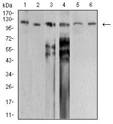Western blot - Anti-SNF2L antibody [2H7B9] (AB233644)
