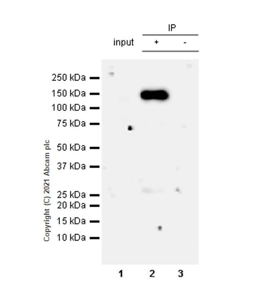 Immunoprecipitation - Anti-SNF2L antibody [EPR12191] - BSA and Azide free (AB249700)