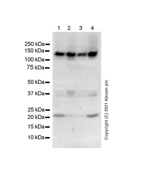 Western blot - Anti-SNF2L antibody [EPR12191] - BSA and Azide free (AB249700)