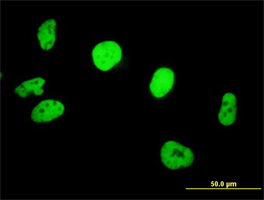 Immunocytochemistry/ Immunofluorescence - Anti-SNF5/SMARCB1 antibody (AB88589)