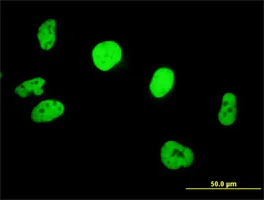 Immunocytochemistry/ Immunofluorescence - Anti-SNF5/SMARCB1 antibody (AB88589)