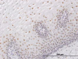 Immunohistochemistry (Formalin/PFA-fixed paraffin-embedded sections) - Anti-SNF5/SMARCB1 antibody (AB88589)