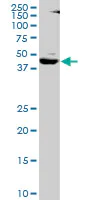 Western blot - Anti-SNF5/SMARCB1 antibody (AB88589)