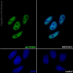Immunocytochemistry/ Immunofluorescence - Anti-SNF5/SMARCB1 antibody [EPR12014-77] (AB192864), expandable thumbnail