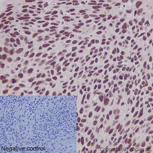 Immunohistochemistry (Formalin/PFA-fixed paraffin-embedded sections) - Anti-SNF5/SMARCB1 antibody [EPR12014-77] (AB192864)