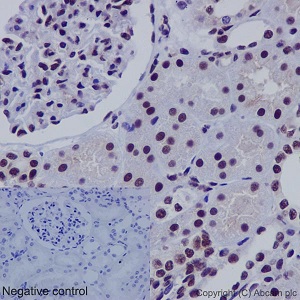 Immunohistochemistry (Formalin/PFA-fixed paraffin-embedded sections) - Anti-SNF5/SMARCB1 antibody [EPR12014-77] (AB192864), expandable thumbnail