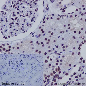 Immunohistochemistry (Formalin/PFA-fixed paraffin-embedded sections) - Anti-SNF5/SMARCB1 antibody [EPR12014-77] (AB192864)
