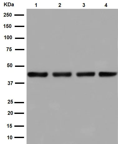 Western blot - Anti-SNF5/SMARCB1 antibody [EPR12014-77] (AB192864)