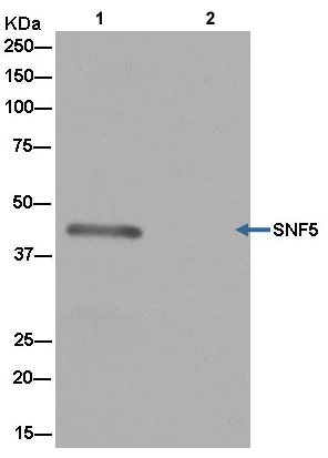 Immunoprecipitation - Anti-SNF5/SMARCB1 antibody [EPR12014] (AB181976)