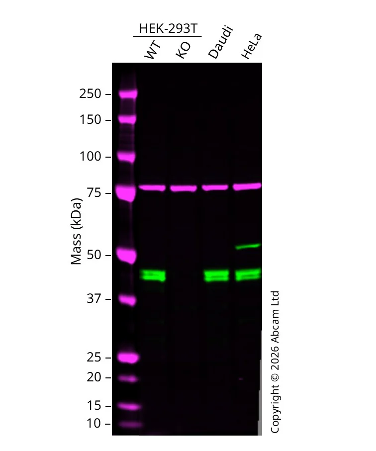 Western blot - Anti-SNF5/SMARCB1 antibody [EPR12014] (AB181976)