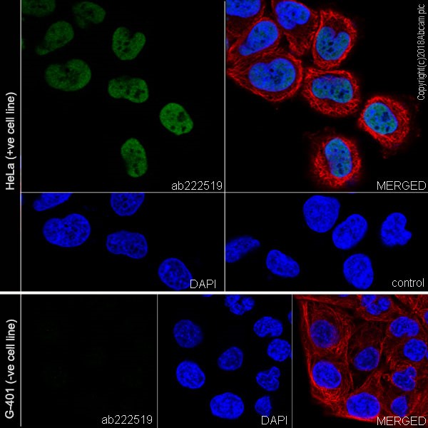 Immunocytochemistry/ Immunofluorescence - Anti-SNF5/SMARCB1 antibody [EPR20189] (ab222519), expandable thumbnail