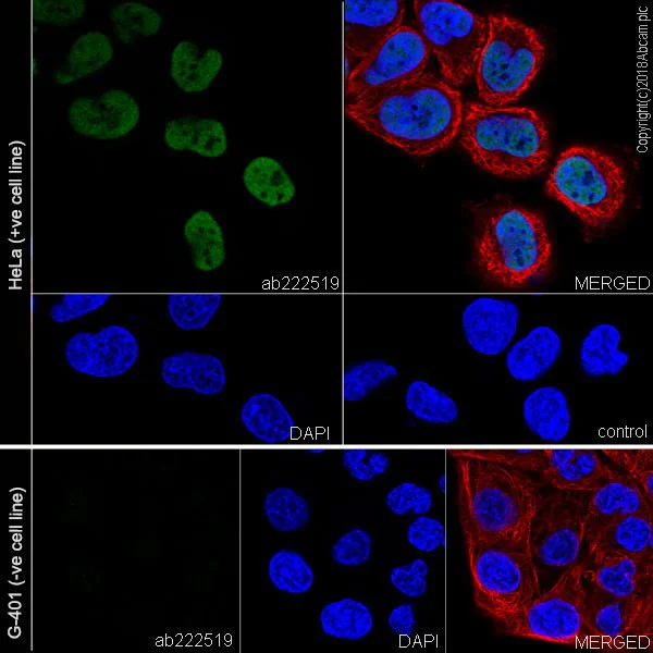 Immunocytochemistry/ Immunofluorescence - Anti-SNF5/SMARCB1 antibody [EPR20189] (AB222519)
