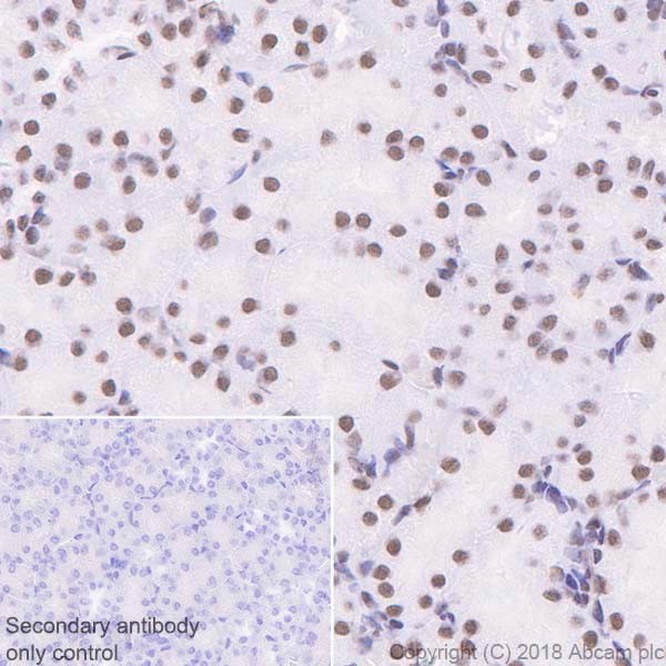 Immunohistochemistry (Formalin/PFA-fixed paraffin-embedded sections) - Anti-SNF5/SMARCB1 antibody [EPR20189] (AB222519), expandable thumbnail