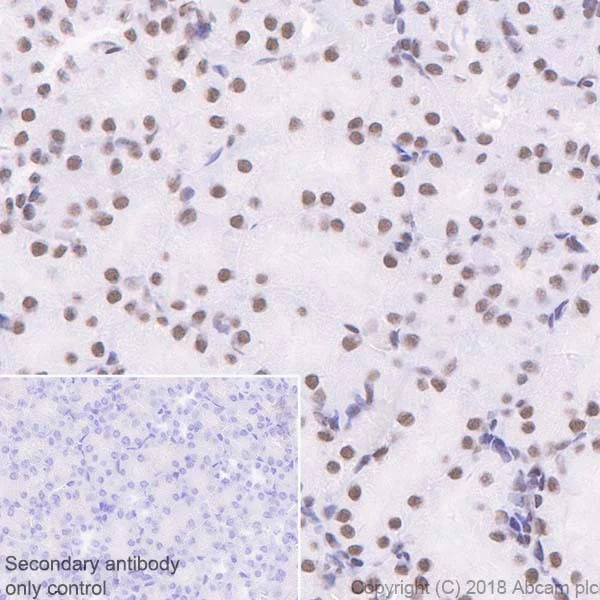 Immunohistochemistry (Formalin/PFA-fixed paraffin-embedded sections) - Anti-SNF5/SMARCB1 antibody [EPR20189] (AB222519)