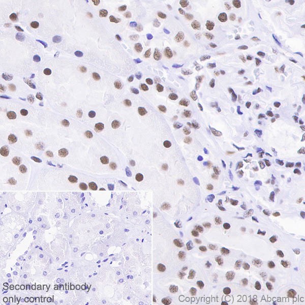 Immunohistochemistry (Formalin/PFA-fixed paraffin-embedded sections) - Anti-SNF5/SMARCB1 antibody [EPR20189] (AB222519), expandable thumbnail