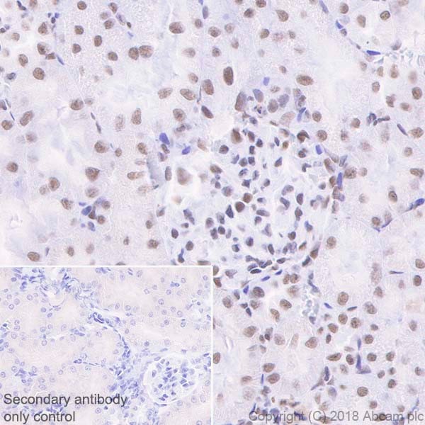 Immunohistochemistry (Formalin/PFA-fixed paraffin-embedded sections) - Anti-SNF5/SMARCB1 antibody [EPR20189] (ab222519), expandable thumbnail