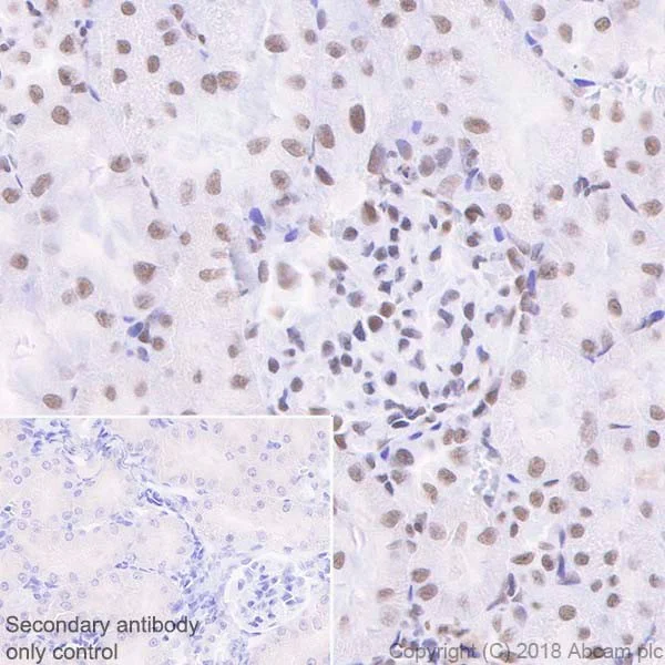 Immunohistochemistry (Formalin/PFA-fixed paraffin-embedded sections) - Anti-SNF5/SMARCB1 antibody [EPR20189] (AB222519)