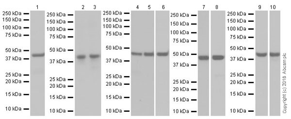 Western blot - Anti-SNF5/SMARCB1 antibody [EPR20189] (AB222519), expandable thumbnail