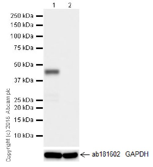 Western blot - Anti-SNF5/SMARCB1 antibody [EPR20189] (AB222519), expandable thumbnail