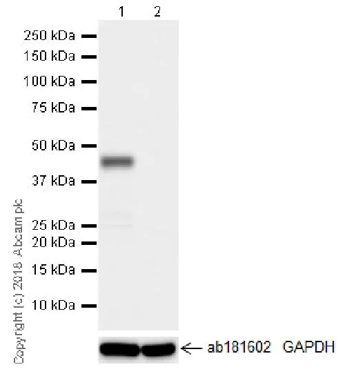 Western blot - Anti-SNF5/SMARCB1 antibody [EPR20189] (AB222519)
