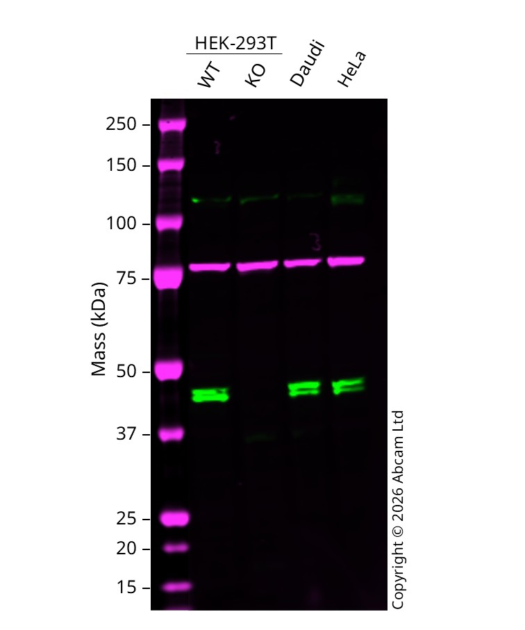 Western blot - Anti-SNF5/SMARCB1 antibody [EPR6966] (AB126734)