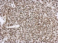 Immunohistochemistry (Formalin/PFA-fixed paraffin-embedded sections) - Anti-SNIP1 antibody (AB126194)