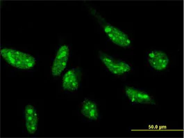 Immunocytochemistry/ Immunofluorescence - Anti-SNIP1 antibody (AB169577)
