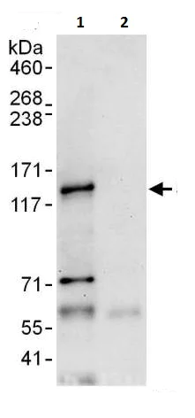 Immunoprecipitation - Anti-SNM1A antibody (AB226003)