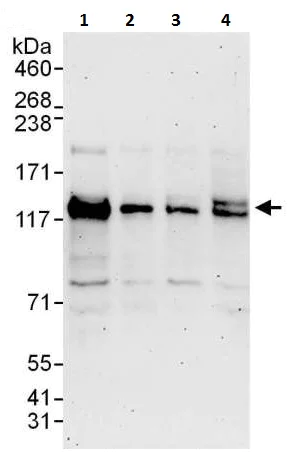Western blot - Anti-SNM1A antibody (AB226003)