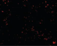 Immunocytochemistry/ Immunofluorescence - Anti-SnoN/SNO antibody - N-terminal (AB189653)