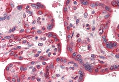 Immunohistochemistry (Formalin/PFA-fixed paraffin-embedded sections) - Anti-SnoN/SNO antibody - N-terminal (AB189653)