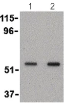 Western blot - Anti-SnoN/SNO antibody - N-terminal (AB189653)