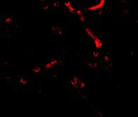 Immunocytochemistry/ Immunofluorescence - Anti-SNPH antibody (AB69992)