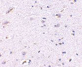 Immunohistochemistry (Formalin/PFA-fixed paraffin-embedded sections) - Anti-SNPH antibody (AB69992), expandable thumbnail