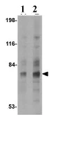 Western blot - Anti-SNPH antibody (AB69992)