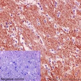 Immunohistochemistry (Formalin/PFA-fixed paraffin-embedded sections) - Anti-SNPH antibody [EPR14115(2)] (AB192605), expandable thumbnail