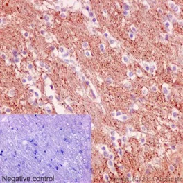 Immunohistochemistry (Formalin/PFA-fixed paraffin-embedded sections) - Anti-SNPH antibody [EPR14115(2)] (AB192605)