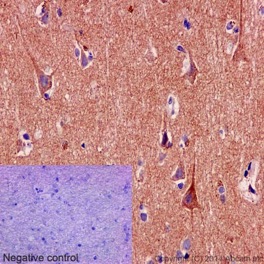 Immunohistochemistry (Formalin/PFA-fixed paraffin-embedded sections) - Anti-SNPH antibody [EPR14115(2)] (AB192605), expandable thumbnail