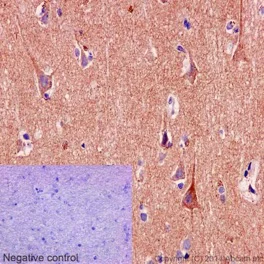 Immunohistochemistry (Formalin/PFA-fixed paraffin-embedded sections) - Anti-SNPH antibody [EPR14115(2)] (AB192605)