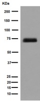 Western blot - Anti-SNPH antibody [EPR14115(2)] (AB192605), expandable thumbnail